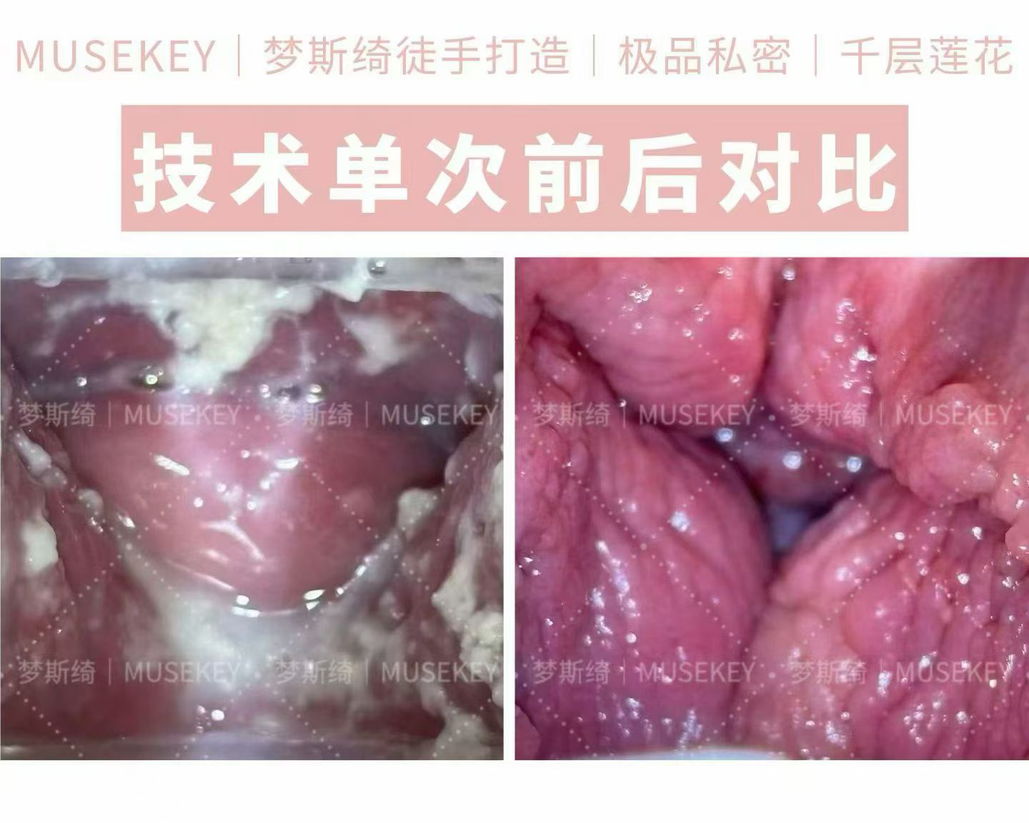 查看第 1 张图片